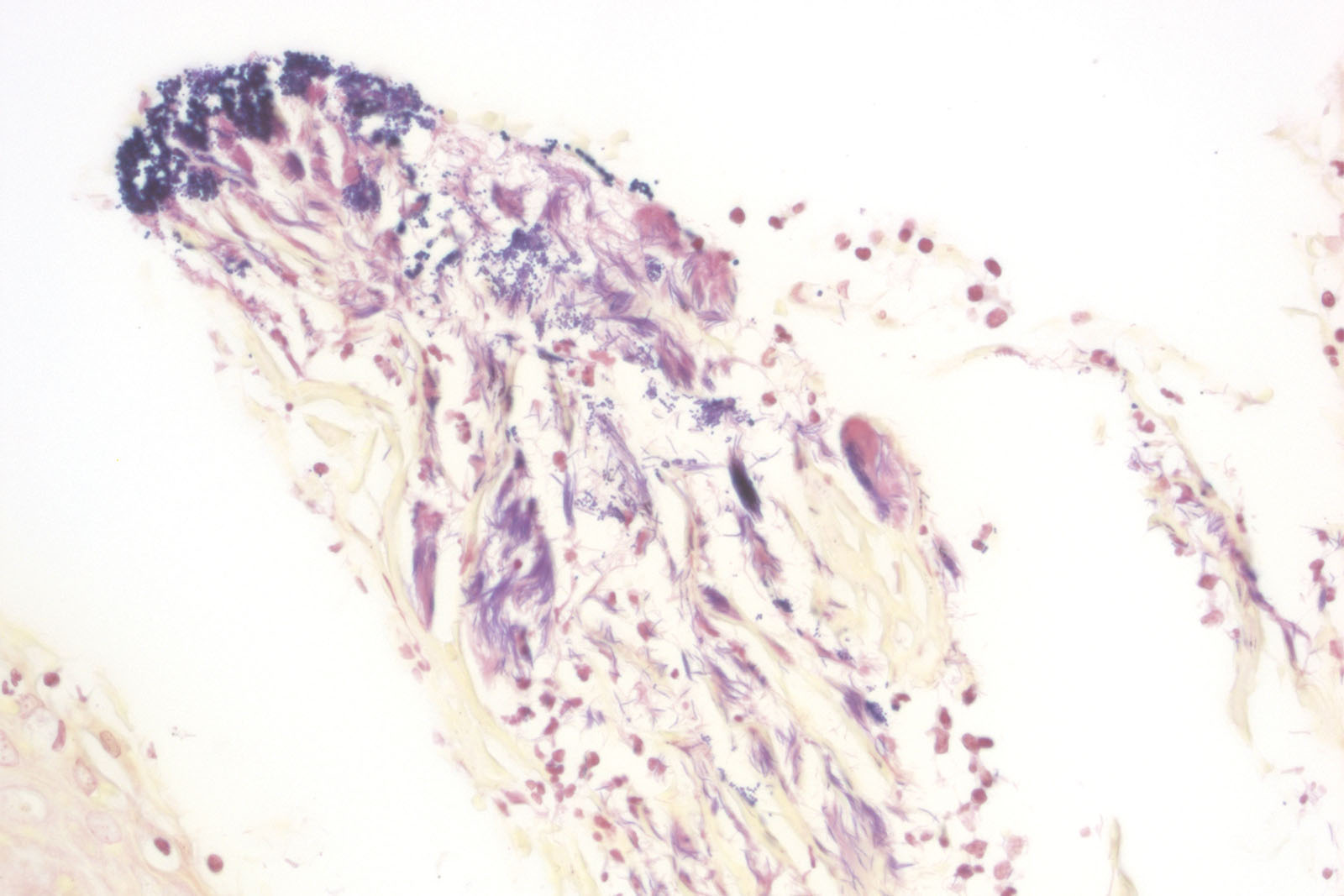 BioGram Histo kit - staining BioGram Histo kit - staining