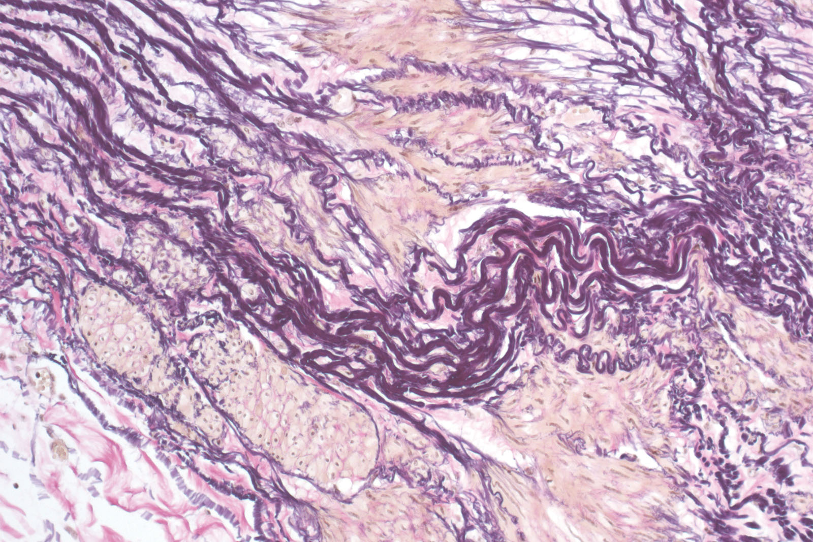 Elastica-Van Gieson kit - staining Elastica-Van Gieson kit - staining