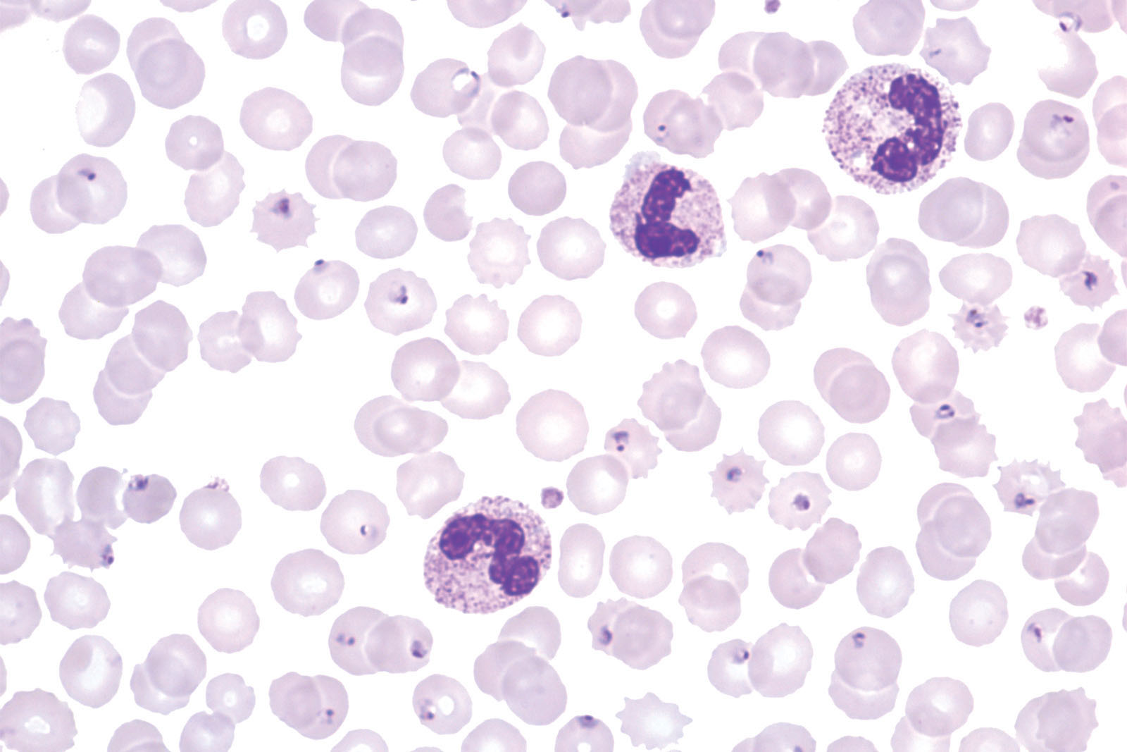 Field kit - staining Field kit - staining