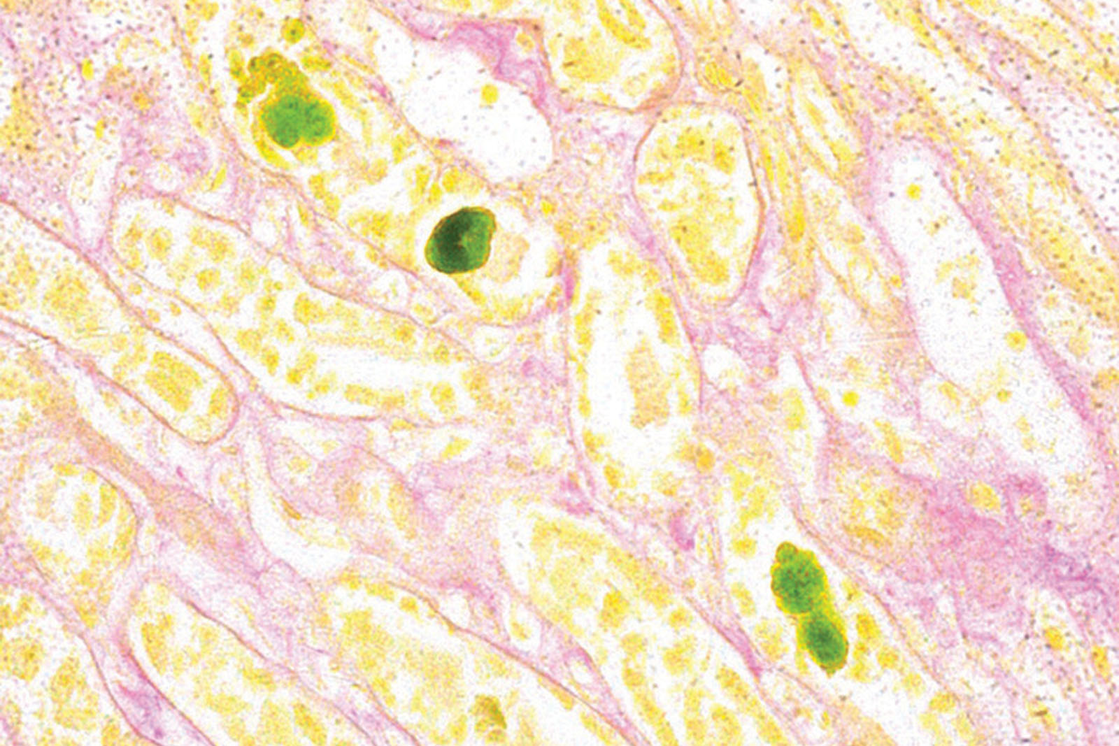 Fouchet-Van Gieson kit - staining Fouchet-Van Gieson kit - staining