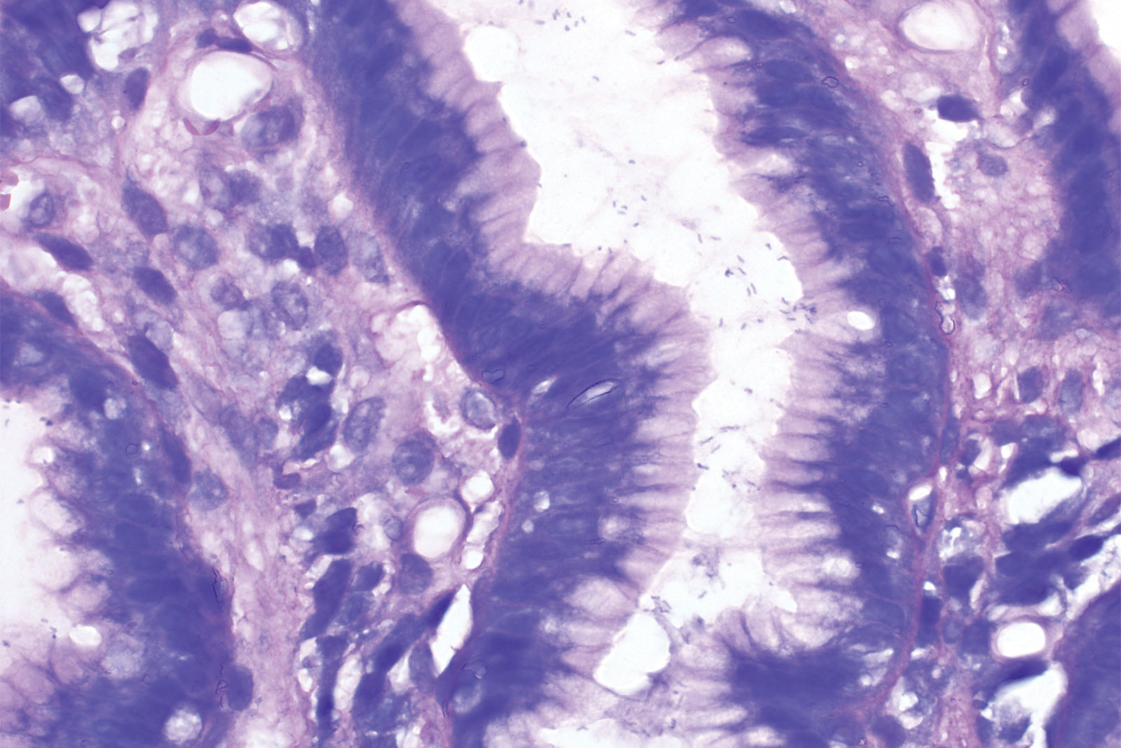 Giemsa HP kit - staining