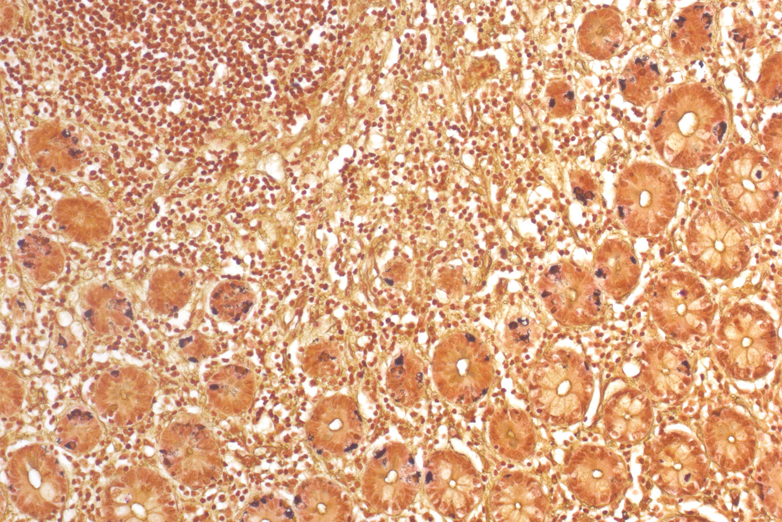 Grimelius kit - staining Grimelius kit - staining