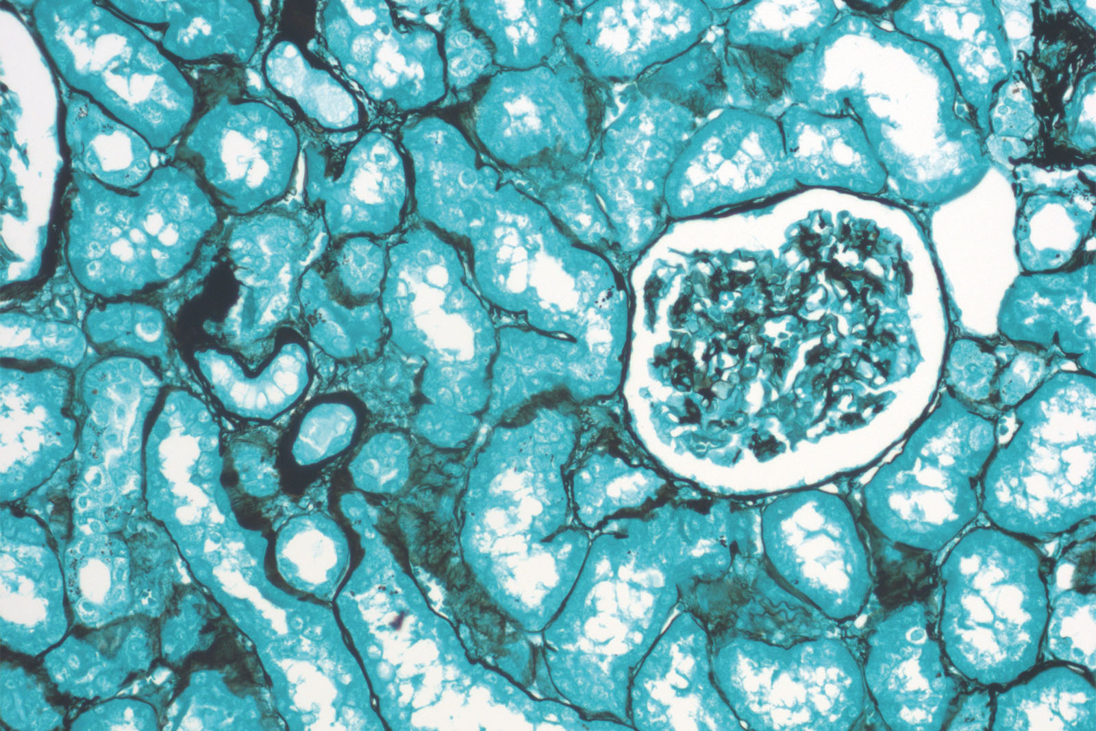 Grocott kit - staining Grocott kit - staining