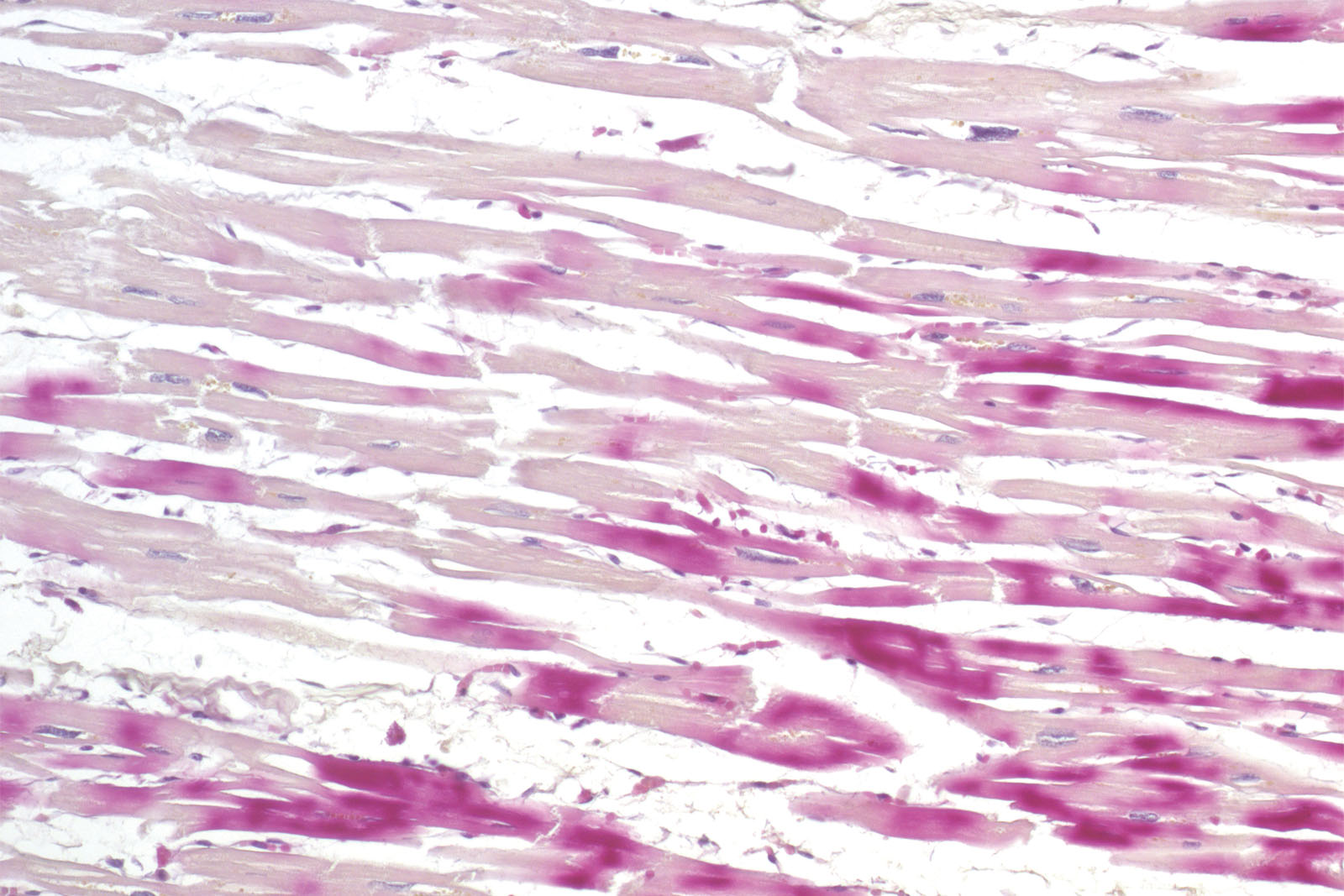 H.B.F.P. kit - staining H.B.F.P. kit - staining