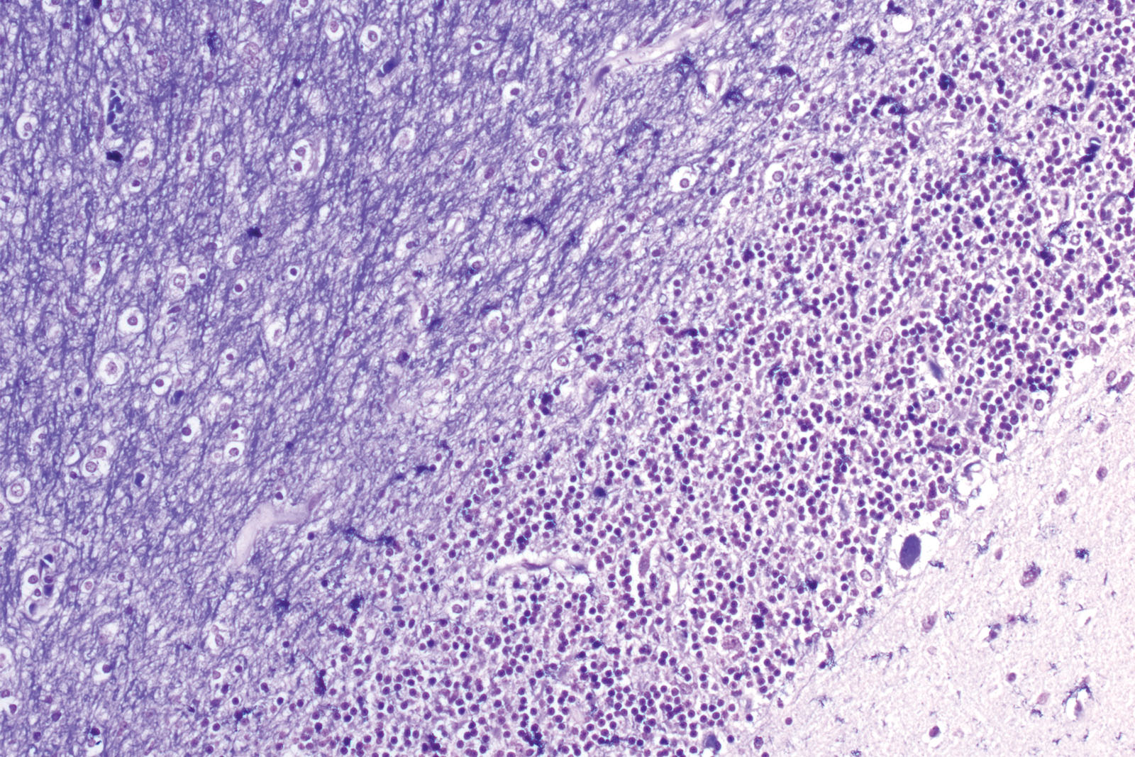 Luxol Fast Blue kit - staining Luxol Fast Blue kit - staining