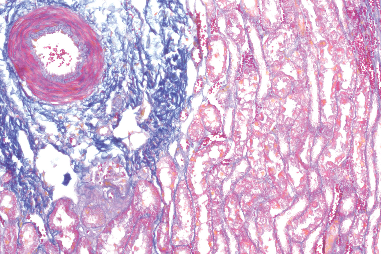 Mallory Trichrome kit - staining