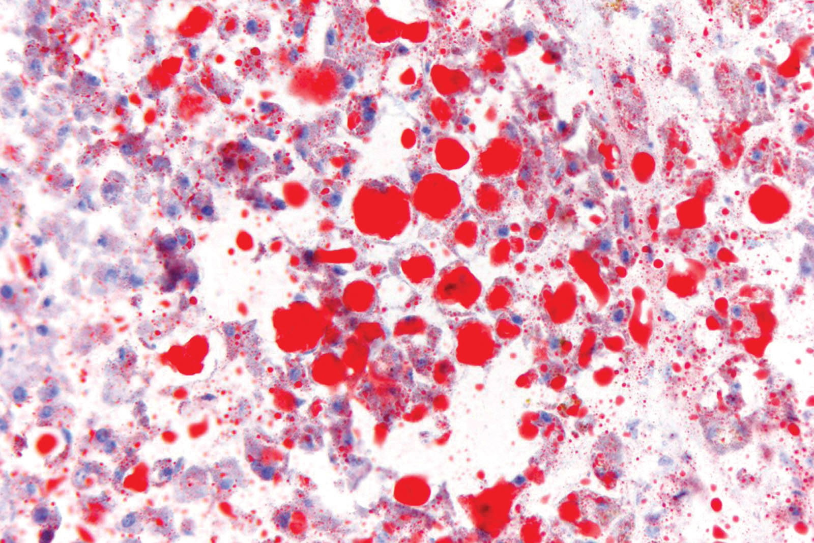 Oil Red O kit - staining