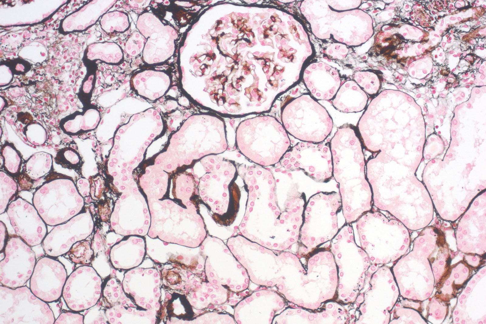 P.A.S.M.-Jones kit - staining