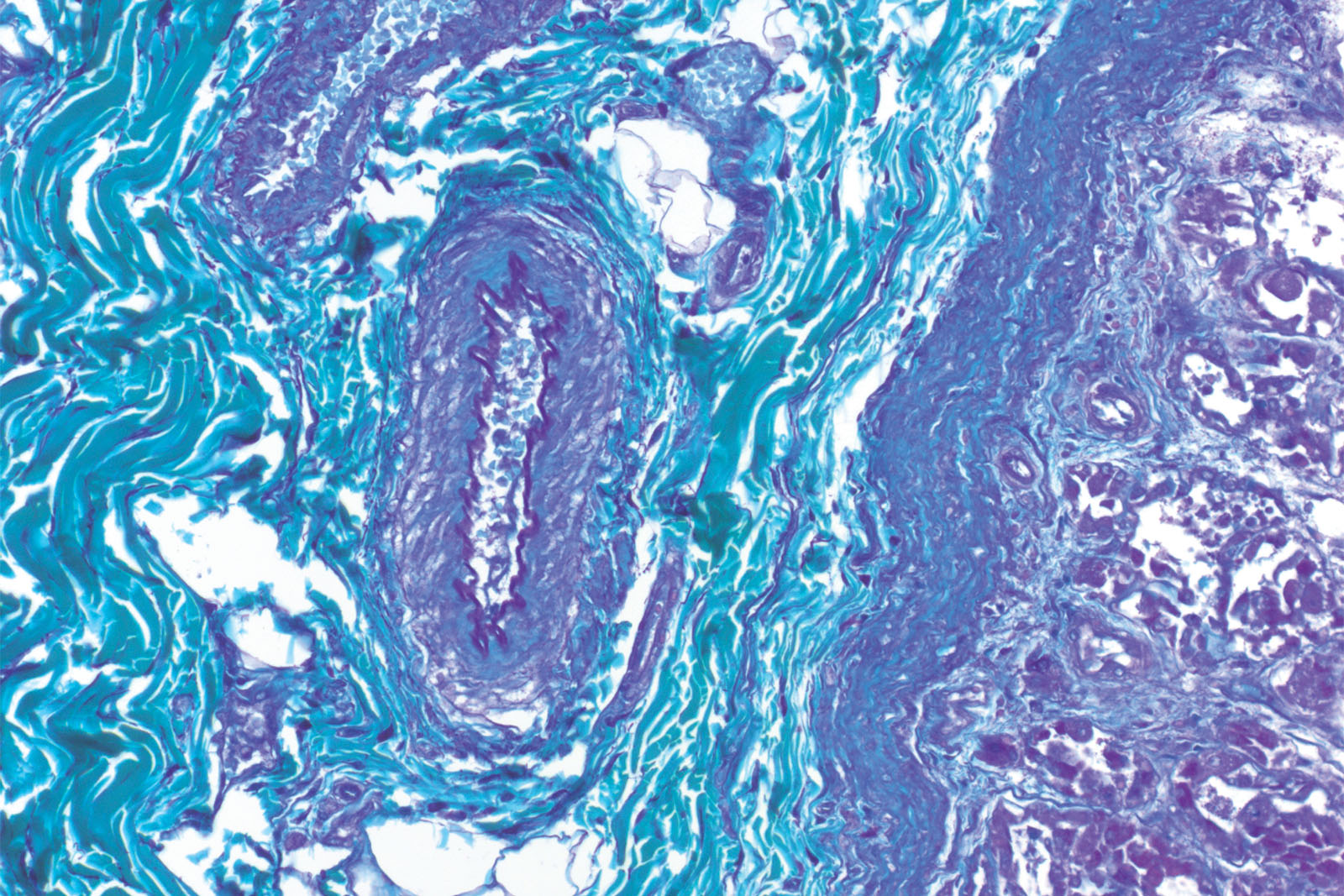 Paraldehyde Fuchsin kit - staining