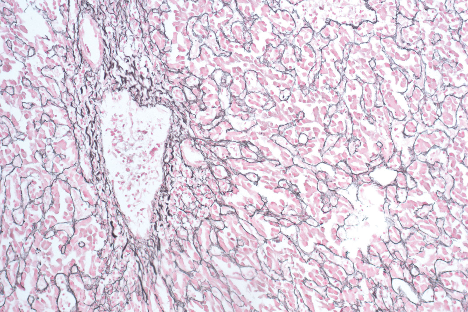 Reticulin contrast kit - staining Reticulin contrast kit - staining