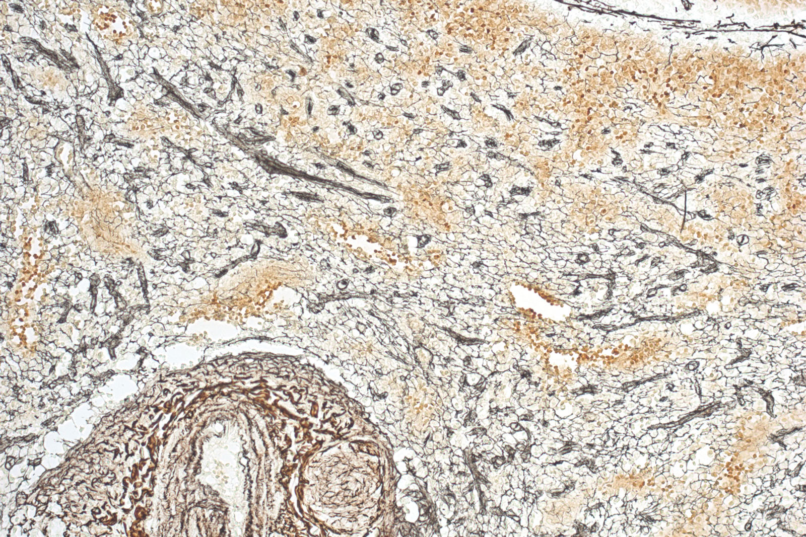 Reticulin kit - staining Reticulin kit - staining