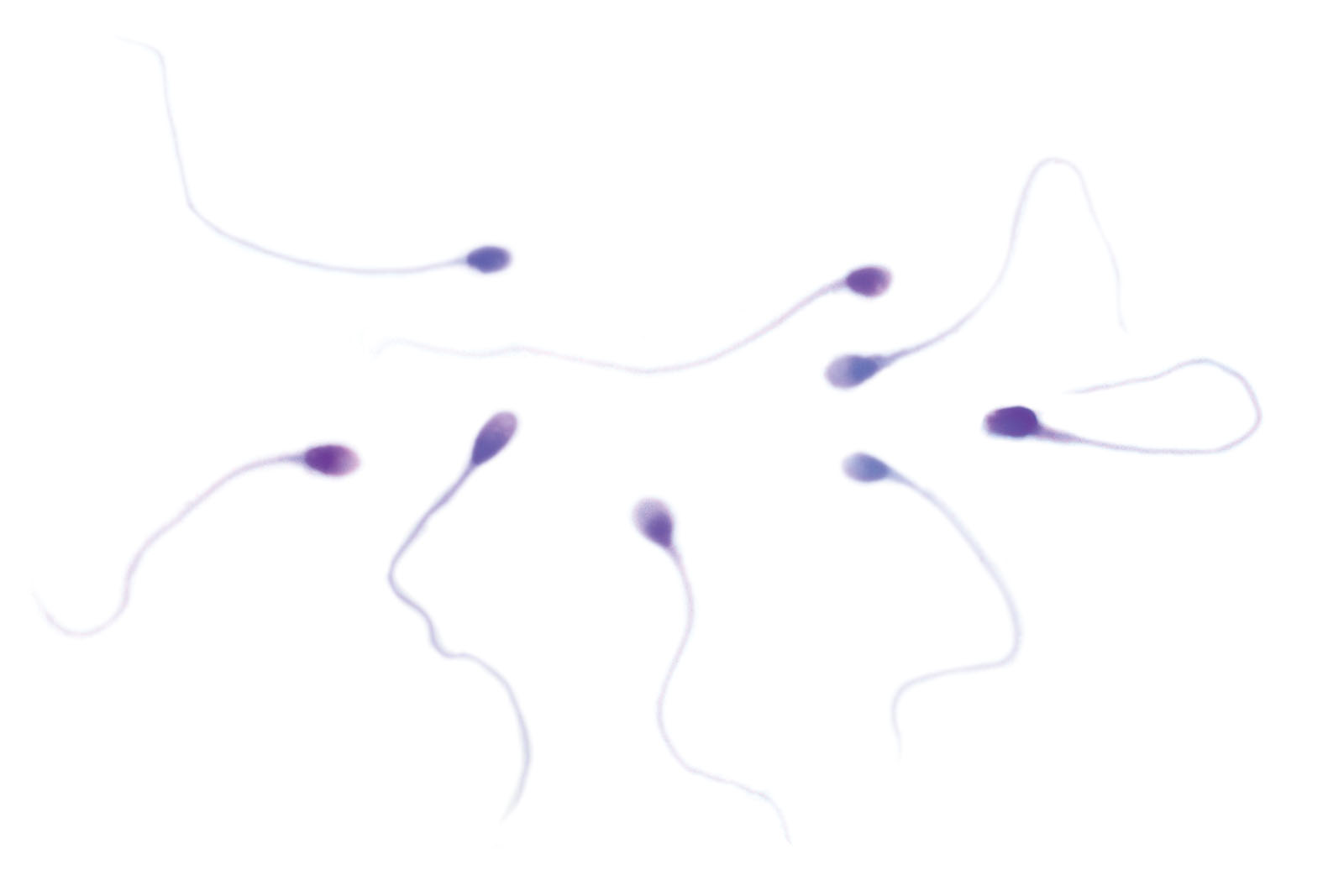 Sperm Diff RTU kit - staining Sperm Diff RTU kit - staining
