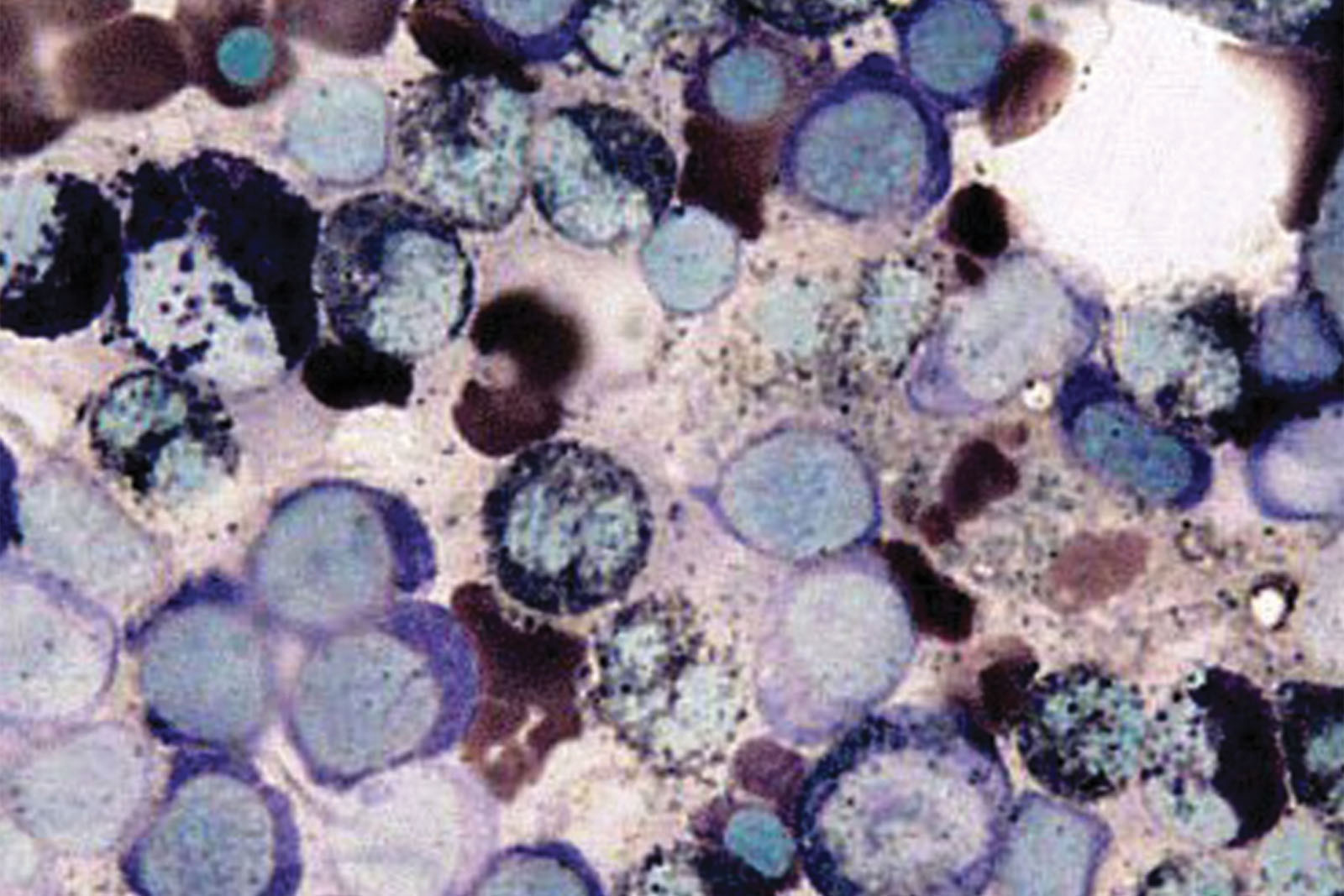 Sudan Black B kit - staining Sudan Black B kit - staining