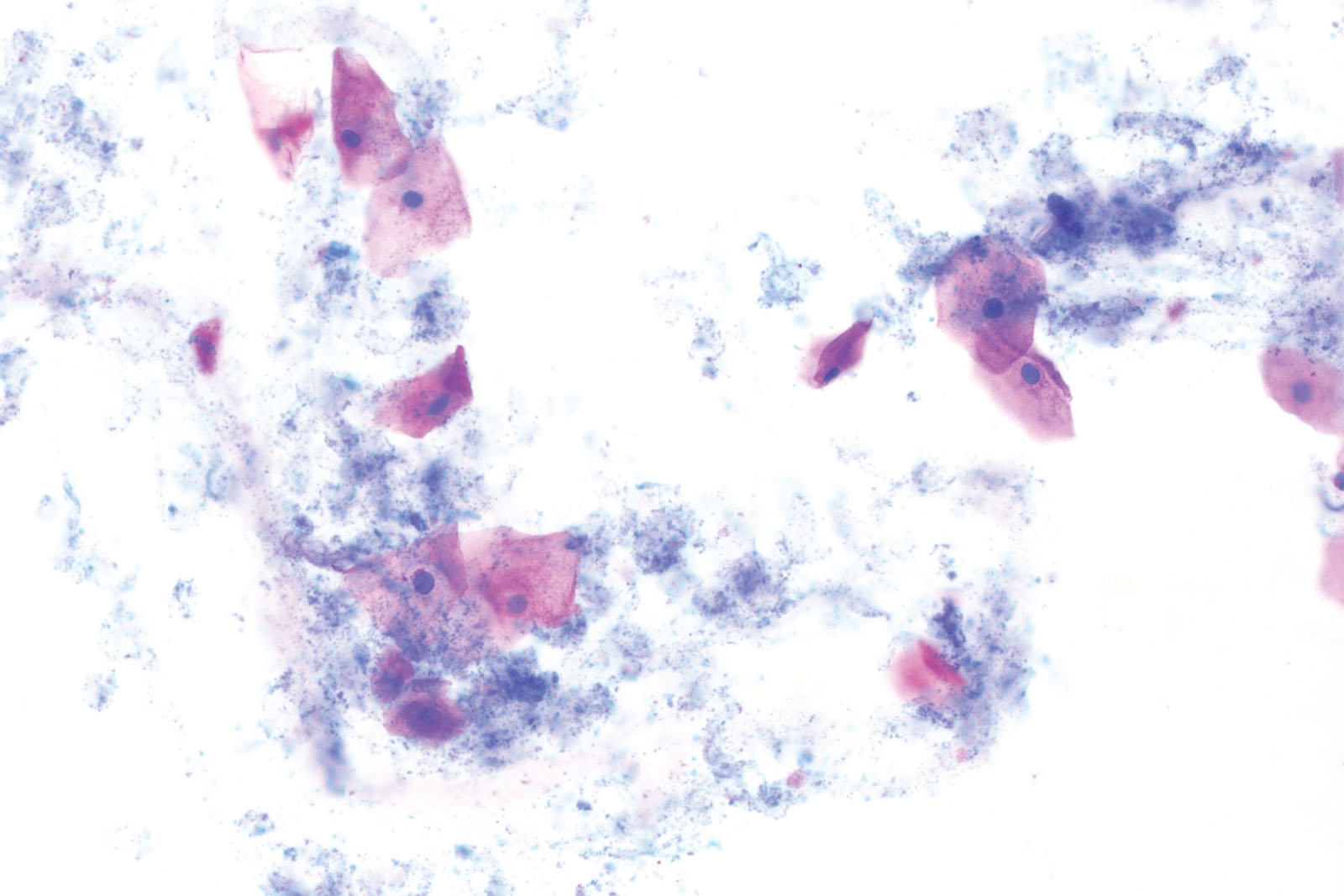 UriGnost S kit - staining UriGnost S kit - staining