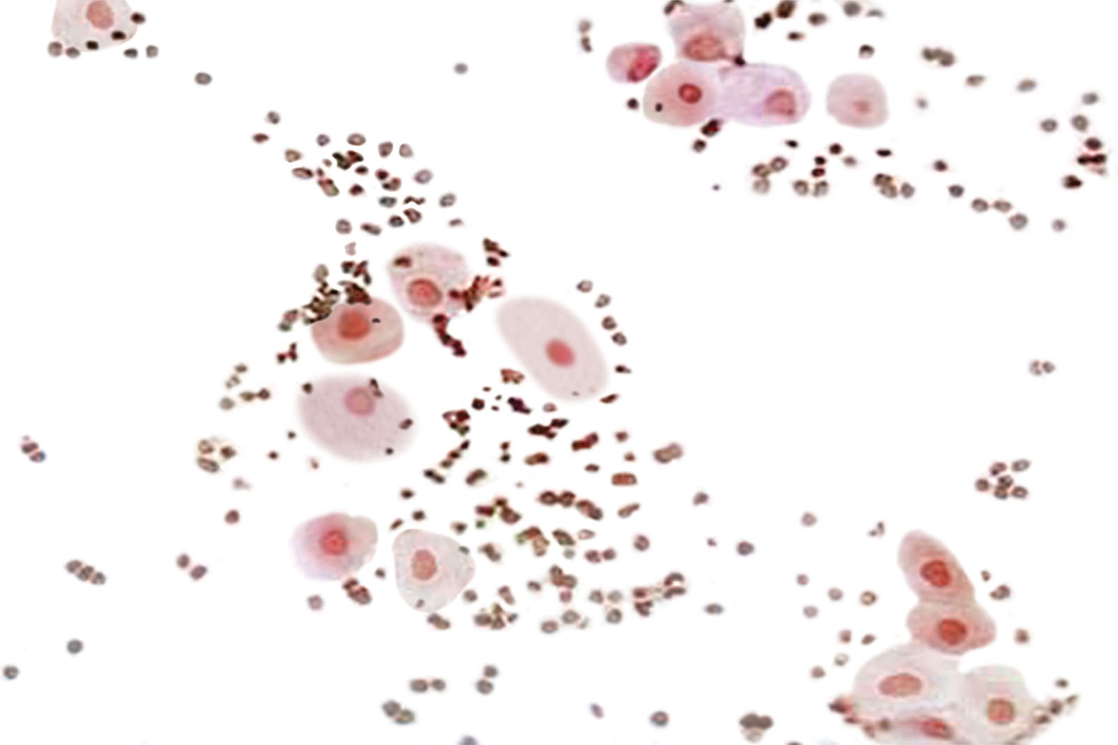 UriGnost SM kit - staining UriGnost SM kit - staining