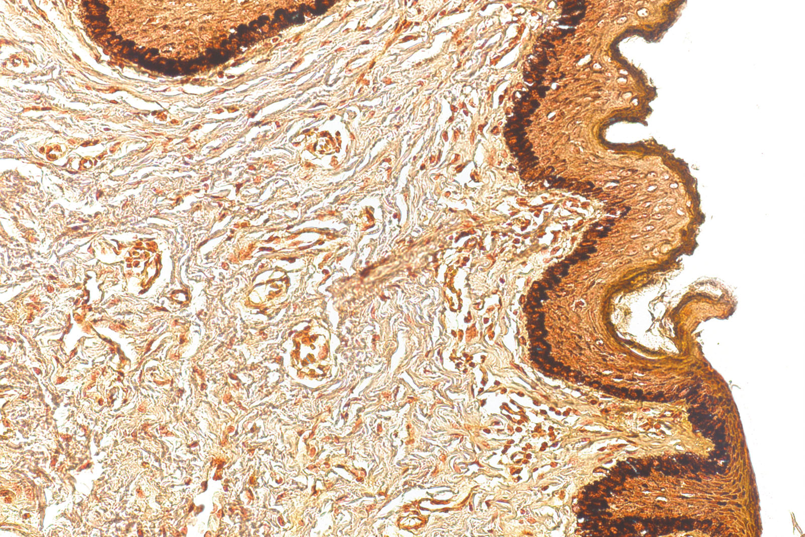 Von Kossa kit - staining Von Kossa kit - staining