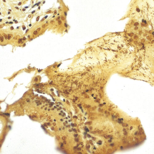 Warthin Starry kit - staining