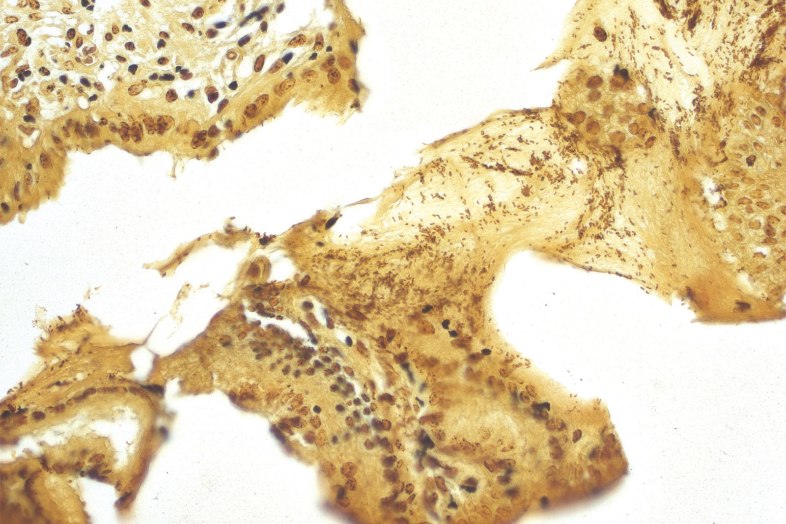 Warthin Starry kit - staining Warthin Starry kit - staining