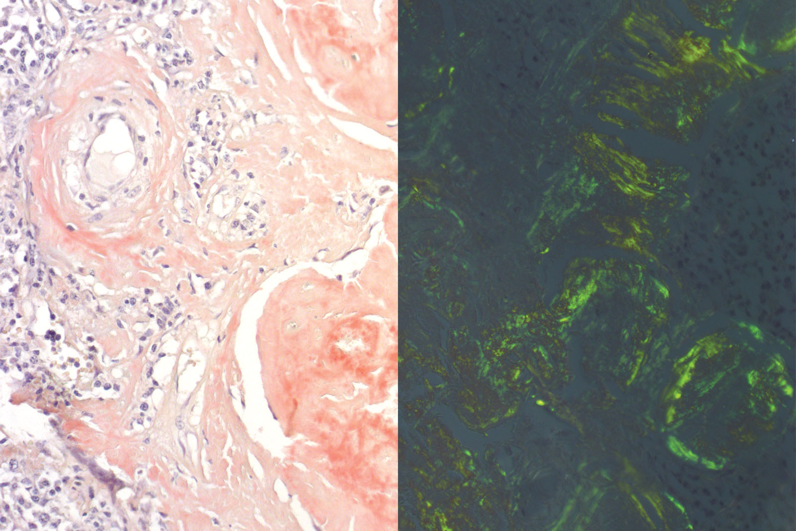 Congo Red Puchtler kit - staining Congo Red Puchtler kit - staining