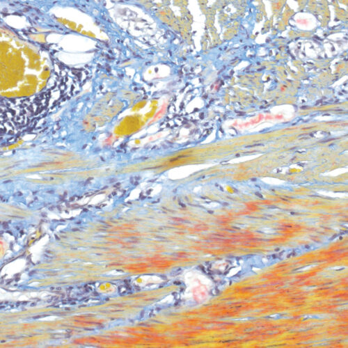 Martius Scarlet Blue (MSB) kit - staining